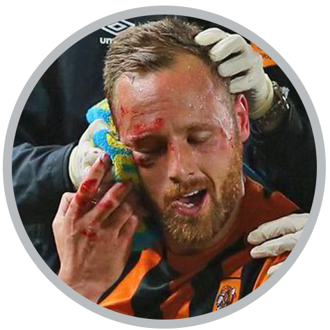 HSC NSFA Facial Injury