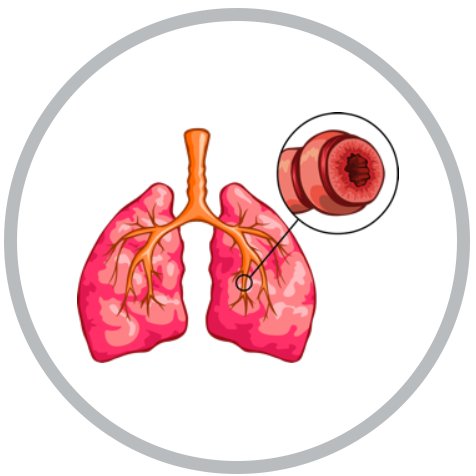 hsc - NSFA - Asthma Attack