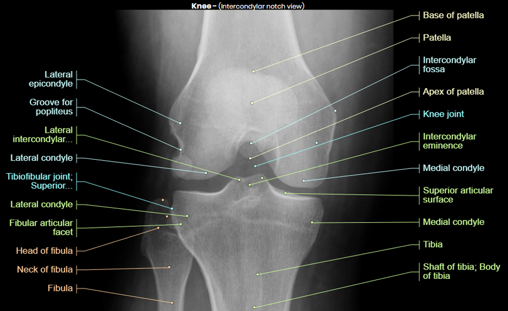 Hampden Sports Clinic, Physio for Women, Women Physio, Womens Health,  Healthy Women, Women in Sport, ACL injury, ACL, Knee Injury, knee rehab, post surgical rehab